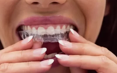 Invisalign Pittsburgh: Clear Aligner Therapy for Discreet Orthodontic Correction